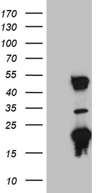 HEK293T cells were transfected with the pCMV6-ENTRY control (Left lane) or pCMV6-ENTRY TRMT12 (Right lane) cDNA for 48 hrs and lysed