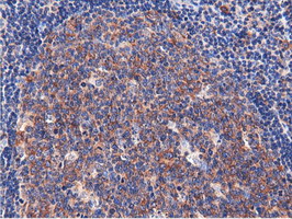 m15555 anti cbwd1 mouse monoclonal antibody clone id oti3f9 ihc testing 10