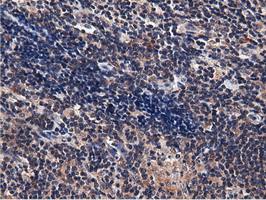 m15555 anti cbwd1 mouse monoclonal antibody clone id oti3f9 ihc testing 11
