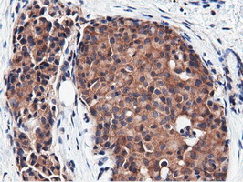 m15555 anti cbwd1 mouse monoclonal antibody clone id oti3f9 ihc testing 12