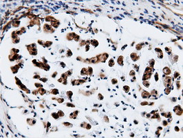 m15555 anti cbwd1 mouse monoclonal antibody clone id oti3f9 ihc testing 13