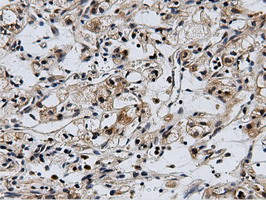 m15555 anti cbwd1 mouse monoclonal antibody clone id oti3f9 ihc testing 14