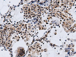 m15555 anti cbwd1 mouse monoclonal antibody clone id oti3f9 ihc testing 3