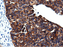 m15555 anti cbwd1 mouse monoclonal antibody clone id oti3f9 ihc testing 4