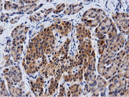 m15555 anti cbwd1 mouse monoclonal antibody clone id oti3f9 ihc testing 5