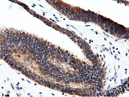 m15555 anti cbwd1 mouse monoclonal antibody clone id oti3f9 ihc testing 6