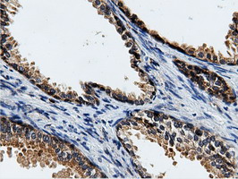 m15555 anti cbwd1 mouse monoclonal antibody clone id oti3f9 ihc testing 7