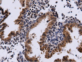 m15555 anti cbwd1 mouse monoclonal antibody clone id oti3f9 ihc testing 8
