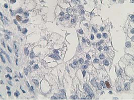 m15632 anti hdhd2 mouse monoclonal antibody clone id oti4g3 ihc testing 2