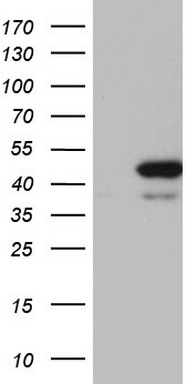 HEK293T cells were transfected with the pCMV6-ENTRY control (Left lane) or pCMV6-ENTRY RMND5A (Right lane) cDNA for 48 hrs and lysed. Equivalent amounts of cell lysates (5 ug per lane) were separated by SDS-PAGE and immunoblotted with anti-RMND5A. HEK293T cells were transfected with the pCMV6-ENTRY control (Left lane) or pCMV6-ENTRY RMND5A (Right lane) cDNA for 48 hrs and lysed. Equivalent amounts of cell lysates (5 ug per lane) were separated by SDS-PAGE and immunoblotted with anti-RMND5A.