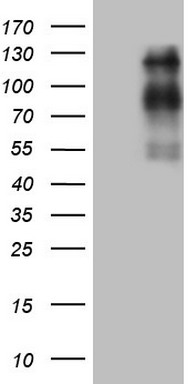 HEK293T cells were transfected with the pCMV6-ENTRY control (Left lane) or pCMV6-ENTRY USP53 (Right lane) cDNA for 48 hrs and lysed