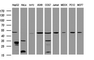 Western blot analysis of extracts (35ug) from 9 different cell lines by using anti-TBC1D13 monoclonal antibody (HepG2: human; HeLa: human; SVT2: mouse; A549: human; COS7: monkey; Jurkat: human; MDCK: canine; PC12: rat; MCF7: human). Dilution: 1:2000