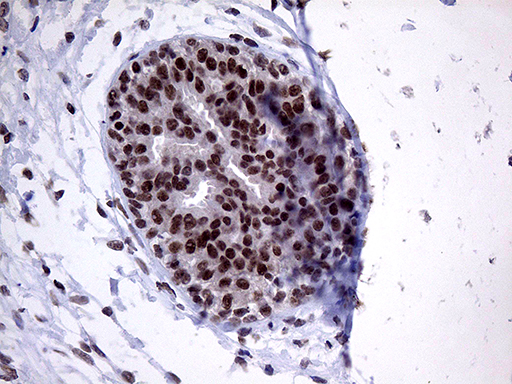 m15890 anti znf329 mouse monoclonal antibody clone id oti2b11 ihc testing 2