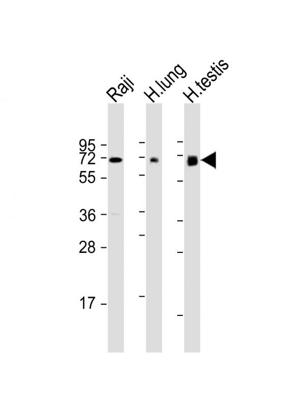 m15907 anti ervk 7 antibody n term wb testing 1