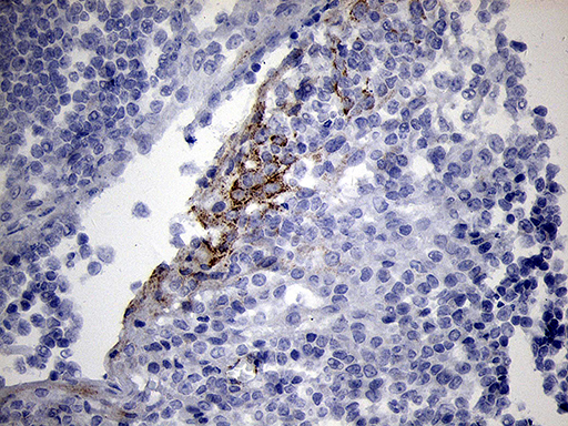 Immunohistochemical staining of paraffin-embedded Human tonsil within the normal limits using anti-NDUFA4L2 mouse monoclonal antibody