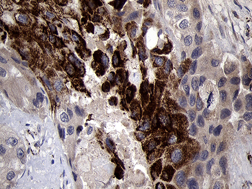 m15915 anti ndufa4l2 mouse monoclonal antibody clone id oti5c10 ihc testing 4