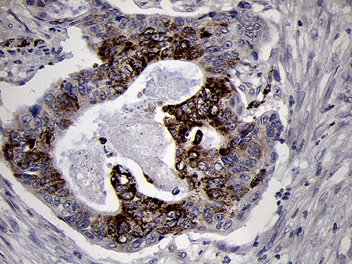 m15915 anti ndufa4l2 mouse monoclonal antibody clone id oti5c10 ihc testing 5