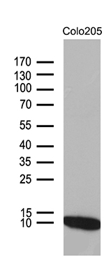 Western blot analysis of extracts (35ug) from COLO205 cell line by using anti-NDUFA4L2 monoclonal antibody (1:500)