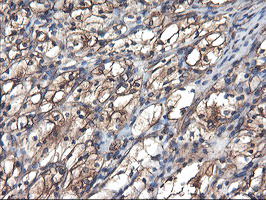 m15933 anti tubal3 mouse monoclonal antibody clone id oti4c5 ihc testing 11