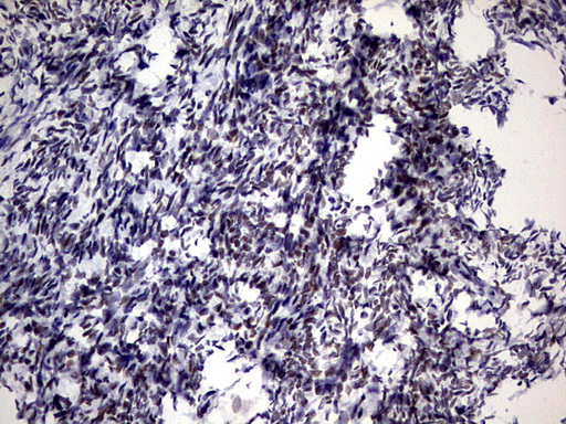 Immunohistochemical staining of paraffin-embedded Human Ovary tissue within the normal limits using anti-ZNF34 mouse monoclonal antibody. (Heat-induced epitope retrieval by 1 mM EDTA in 10mM Tris