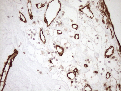 m16018 anti aspdh mouse monoclonal antibody clone id oti4g8 ihc testing 11