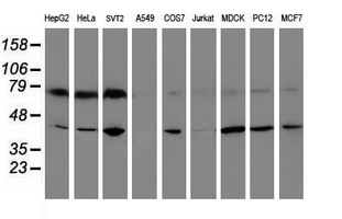 Western blot analysis of extracts (35ug) from 9 different cell lines by using anti-CRYZL1 monoclonal antibody.