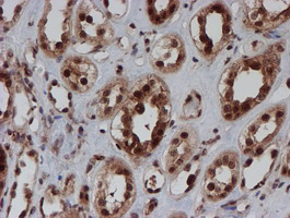 m16122 anti cryzl1 mouse monoclonal antibody clone id oti2f9 ihc testing 10