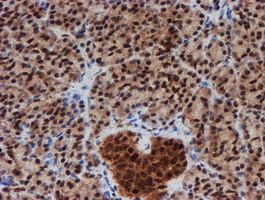 m16122 anti cryzl1 mouse monoclonal antibody clone id oti2f9 ihc testing 4