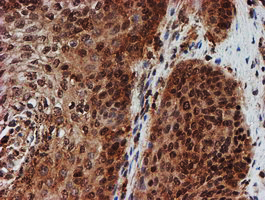 m16122 anti cryzl1 mouse monoclonal antibody clone id oti2f9 ihc testing 8