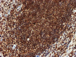 m16122 anti cryzl1 mouse monoclonal antibody clone id oti2f9 ihc testing 9