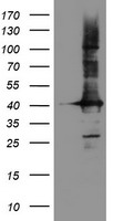 HEK293T cells were transfected with the pCMV6-ENTRY control (Left lane) or pCMV6-ENTRY CRYZL1 (Right lane) cDNA for 48 hrs and lysed