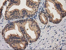 m16123 anti chchd5 mouse monoclonal antibody clone id oti9e6 ihc testing 10