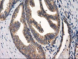 m16123 anti chchd5 mouse monoclonal antibody clone id oti9e6 ihc testing 11