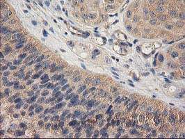 m16123 anti chchd5 mouse monoclonal antibody clone id oti9e6 ihc testing 12