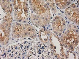 m16123 anti chchd5 mouse monoclonal antibody clone id oti9e6 ihc testing 14