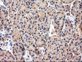m16123 anti chchd5 mouse monoclonal antibody clone id oti9e6 ihc testing 4