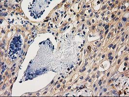 m16123 anti chchd5 mouse monoclonal antibody clone id oti9e6 ihc testing 5