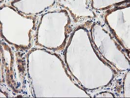 m16123 anti chchd5 mouse monoclonal antibody clone id oti9e6 ihc testing 6