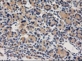 m16123 anti chchd5 mouse monoclonal antibody clone id oti9e6 ihc testing 7