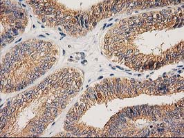 m16123 anti chchd5 mouse monoclonal antibody clone id oti9e6 ihc testing 9