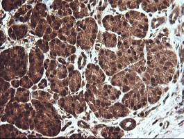 Immunohistochemical staining of paraffin-embedded Human pancreas tissue within the normal limits using anti-CCT8L2 mouse monoclonal antibody