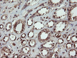 Immunohistochemical staining of paraffin-embedded Human Kidney tissue within the normal limits using anti-CCT8L2 mouse monoclonal antibody