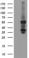 HEK293T cells were transfected with the pCMV6-ENTRY control (Left lane) or pCMV6-ENTRY CCT8L2 (Right lane) cDNA for 48 hrs and lysed