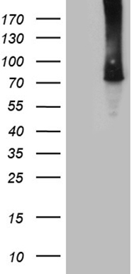 HEK293T cells were transfected with the pCMV6-ENTRY control (Left lane) or pCMV6-ENTRY TTC30B (Right lane) cDNA for 48 hrs and lysed