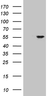 HEK293T cells were transfected with the pCMV6-ENTRY control (Left lane) or pCMV6-ENTRY ZNF610 (Right lane) cDNA for 48 hrs and lysed