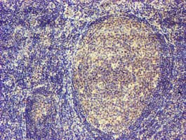 m16185 1 anti mageb18 mouse monoclonal antibody clone id oti9f9 ihc testing 2