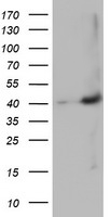 m16185 1 anti mageb18 mouse monoclonal antibody clone id oti9f9 wb testing 1