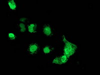 m16185 anti mageb18 mouse monoclonal antibody clone id oti1f5 if testing 3