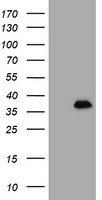 m16185 anti mageb18 mouse monoclonal antibody clone id oti1f5 wb testing 1
