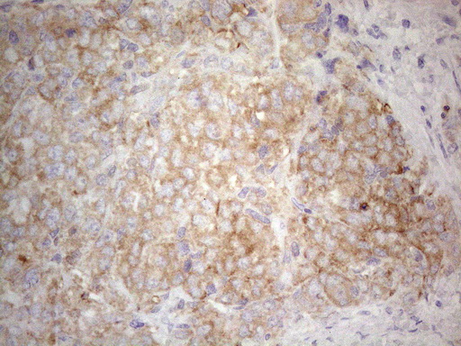m16218 anti plcxd1 mouse monoclonal antibody clone id oti2d7 ihc testing 2